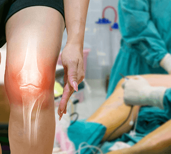 PERSONALIZED 3D KNEE REPLACEMENT